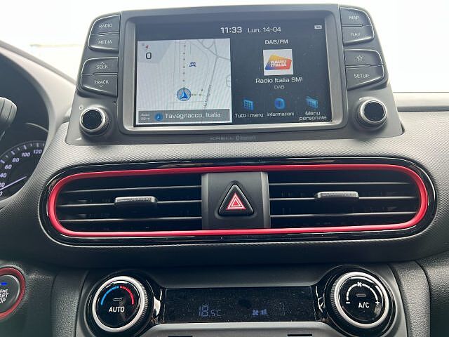 Hyundai KONA 1.6 CRDI 115 CV Xpossible